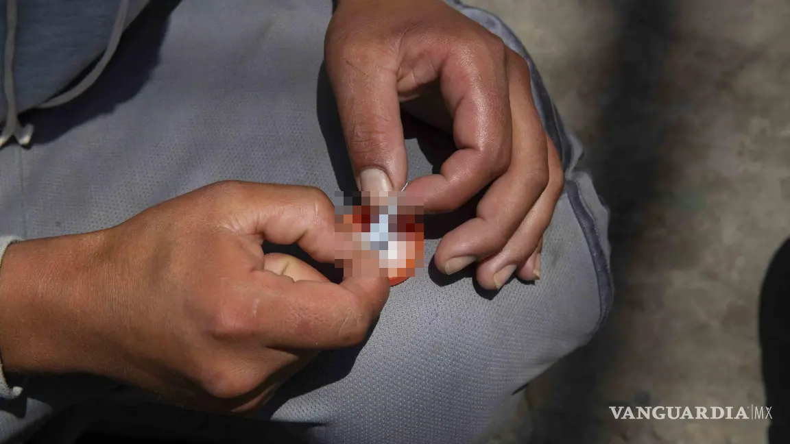 SS sigue sin registrar casos de fentanilo en Coahuila SS sigue sin registrar casos de fentanilo en Coahuila