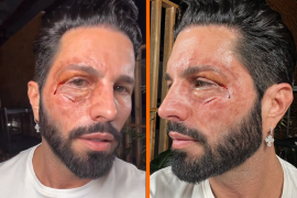 Adal Ramones responde con humor, alimentando la tensa relación previa. El episodio se suma a la historia de conflictos entre ambos, incluyendo una confrontación viral en diciembre pasado